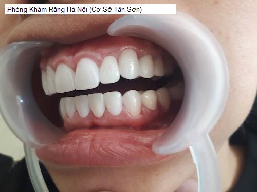 Yến Sào Phú Thọ - Gợi ý 2 Nha Khoa tốt nhất khu vực Huyện Tân Sơn